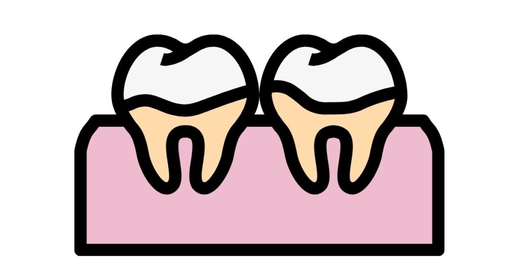 what-happens-if-tartar-is-not-removed-perfect-dental