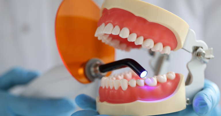 Can Dental Fillings Fall Out?