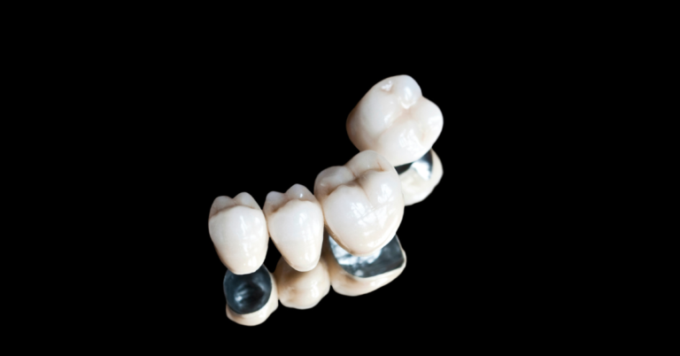 Can a dental crown be repaired?