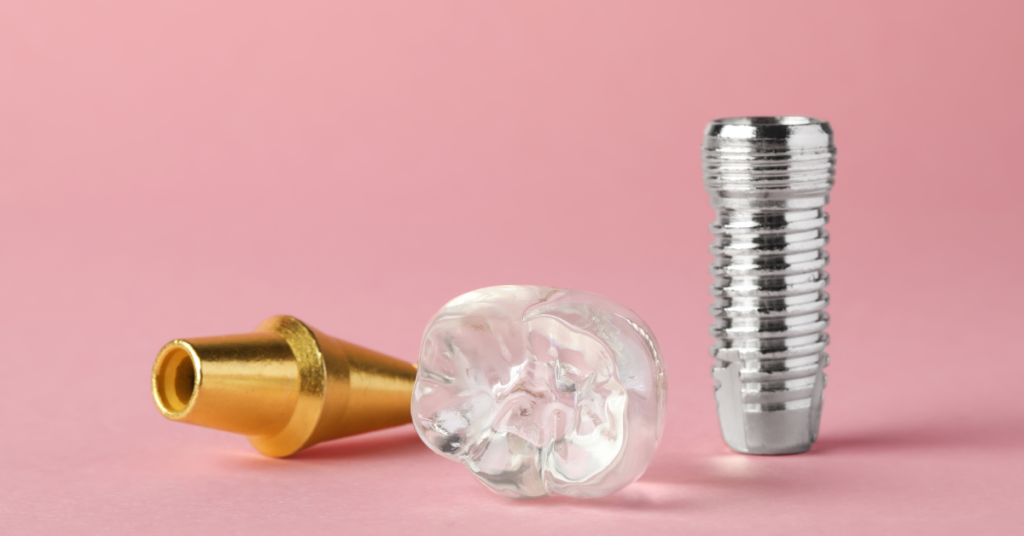 Can dental implant crowns be removed? Perfect Dental