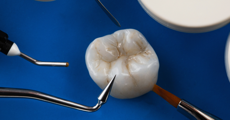 Is a chipped crown a dental emergency?