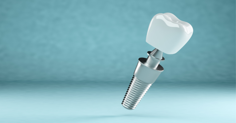 Why No Dairy After Dental Implant?